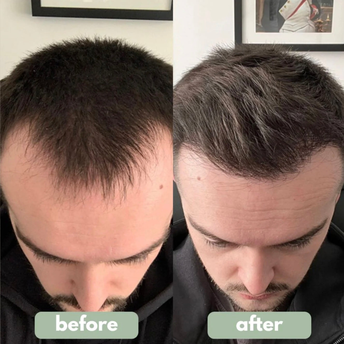 Reverse™ - Hair Growth Serum